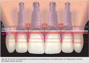 710576-konische-innenverbindung