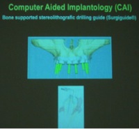 implantate20